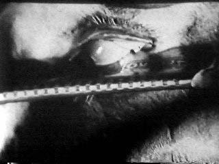 Buñuel, Luis; Dali, Salvador »Un chien andalou (Der andalusische Hund)« | Augenschnitt